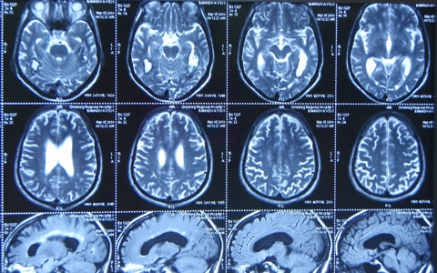 magnamed_mrt-golovnogo-mozga irm mrt chisinau preturi accesibile-min